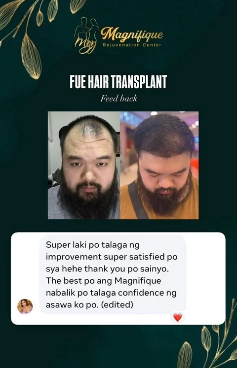 Message sent to Magnifique by a patient’s spouse after his FUE hair transplant, above his before and after photos: a big improvement, very satisfied, and his confidence is back